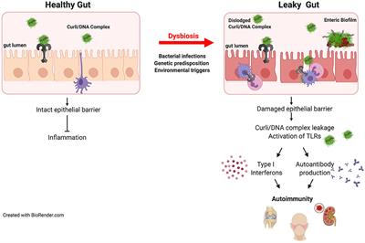 Microbiome or Infections: Amyloid-Containing Biofilms as a Trigger for Complex Human Diseases